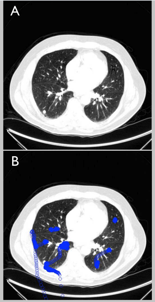 X Ray study